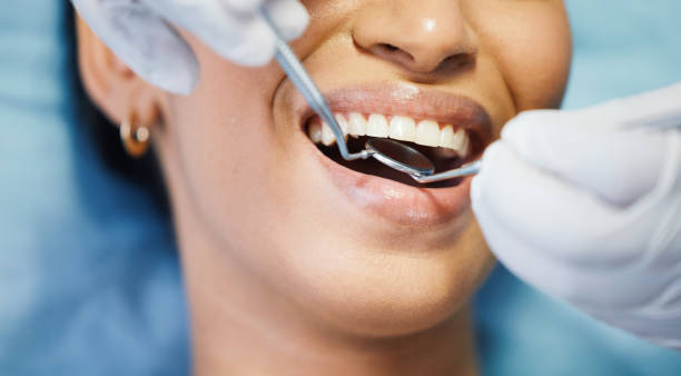Best Emergency Root Canal Treatment in Pass Christian, MS